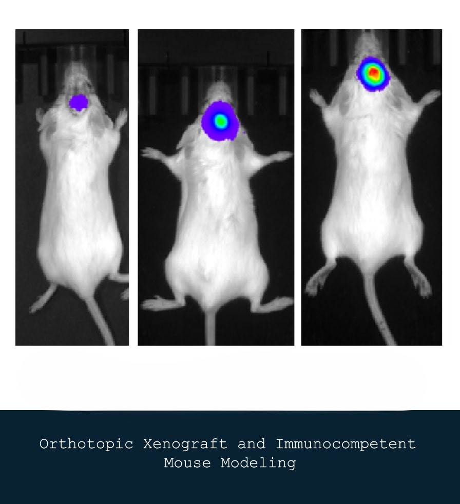 Orthotopic Patient-Derived Xenograft Modeling